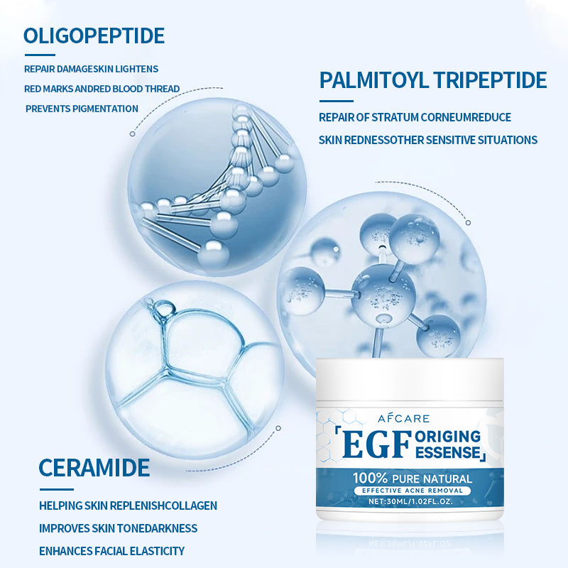 EGF Face Cream Acne Treatment Lightening Remover Pimple Repair