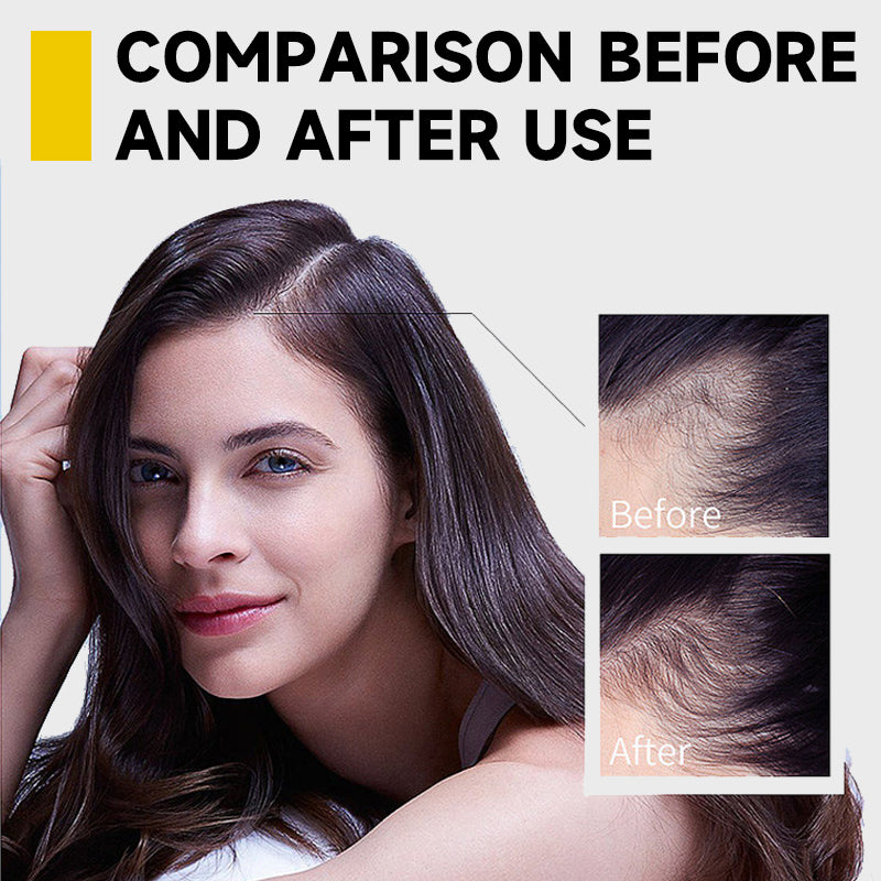 "Turmeric Hair Growth Essential Oil - Boost Your Hair Health!"
