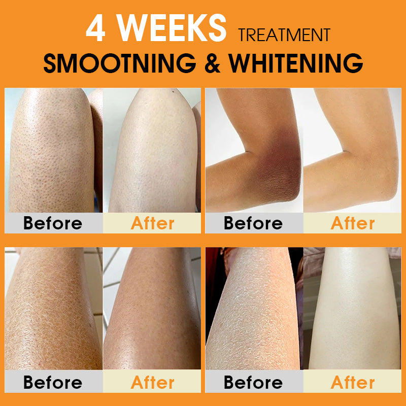 Turmeric Body Cream Chicken Skin Removal Treatment Keratosis Pilaris Lotion Rough Bumpy Moisturizer Whitening Creams