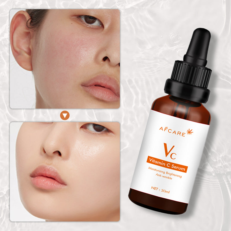 "Transform Your Skin with VC Serum: Vitamin C Powerhouse"